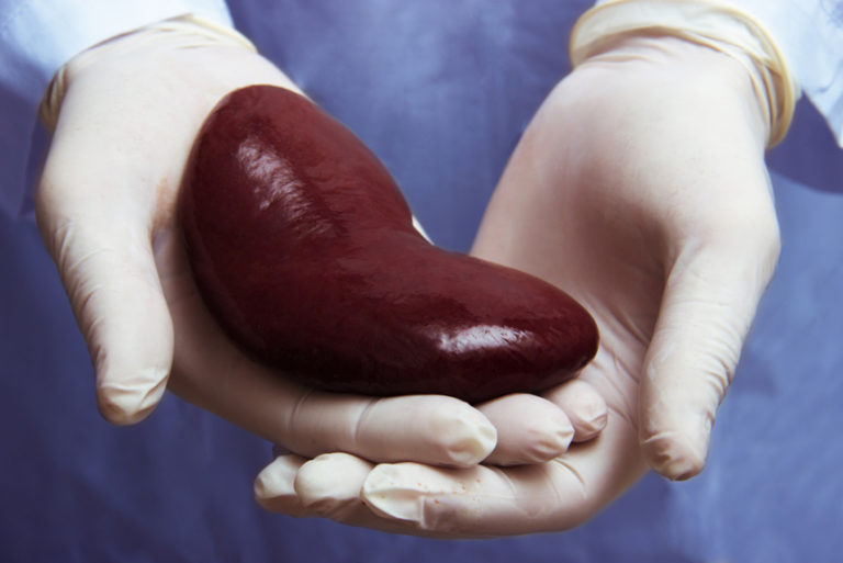 What Was The First Successful Organ Transplant